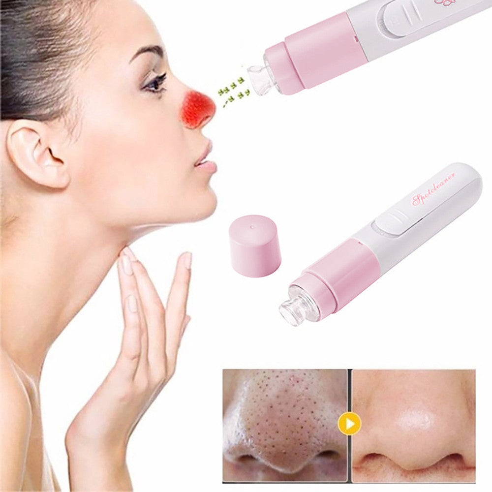 Facia Blackhead Removal Tool